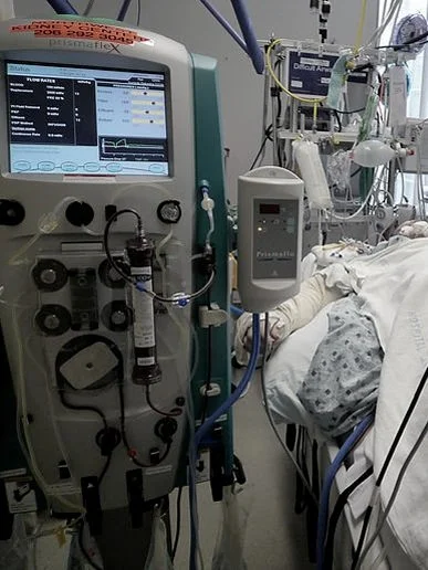 Patient lying in bed surrounded by machines