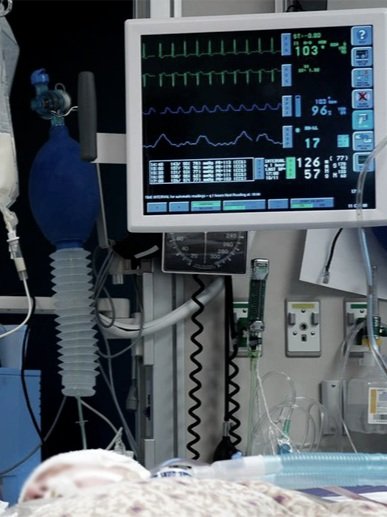 Patient lying in bed with monitor showing