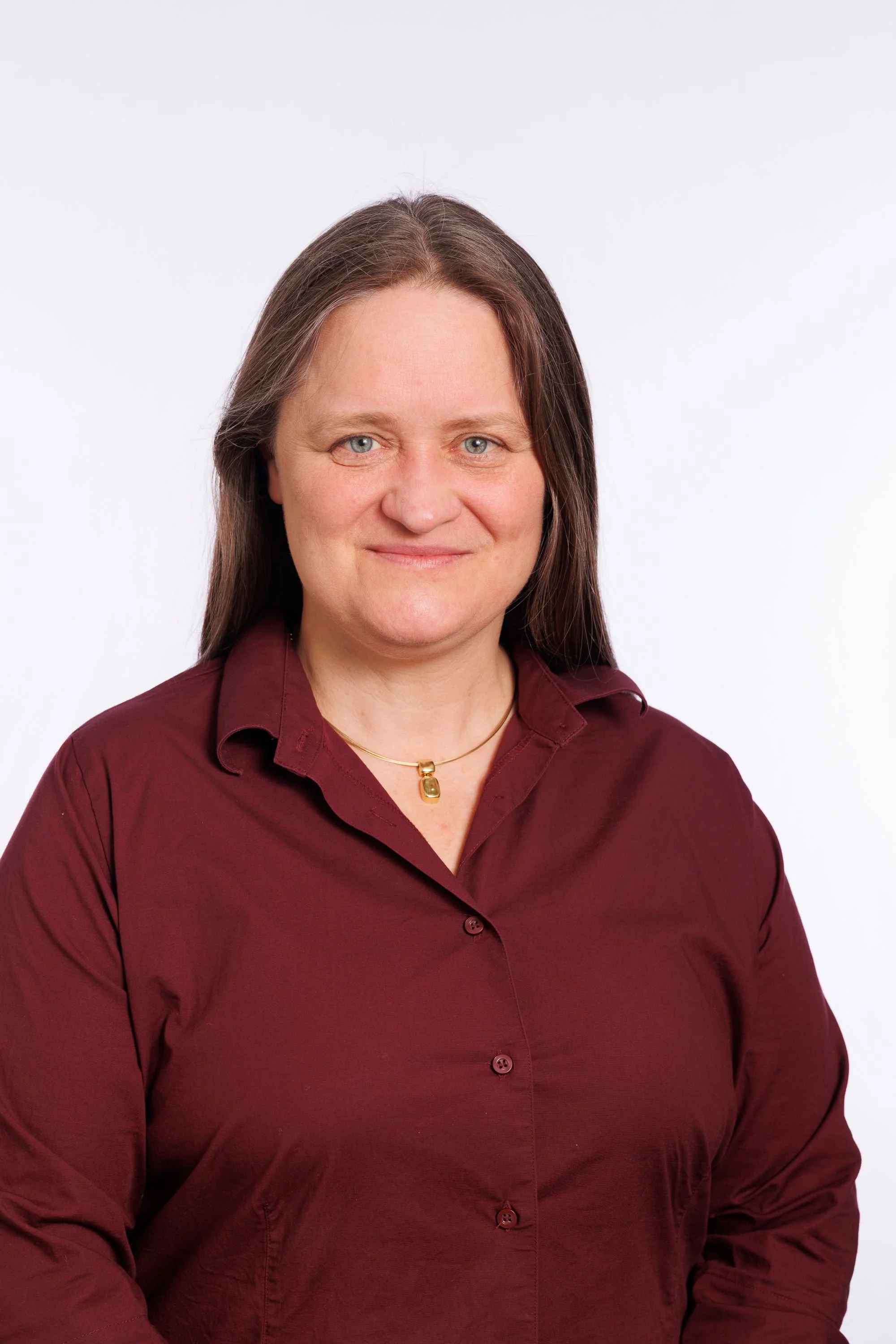 Mobile Stroke Units could reduce emergency department transfers by 86%