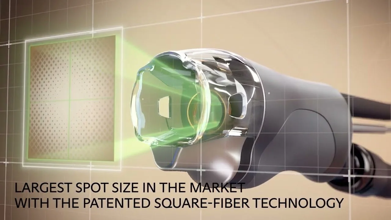 Lumenis Splendor X handpiece nw.jpg