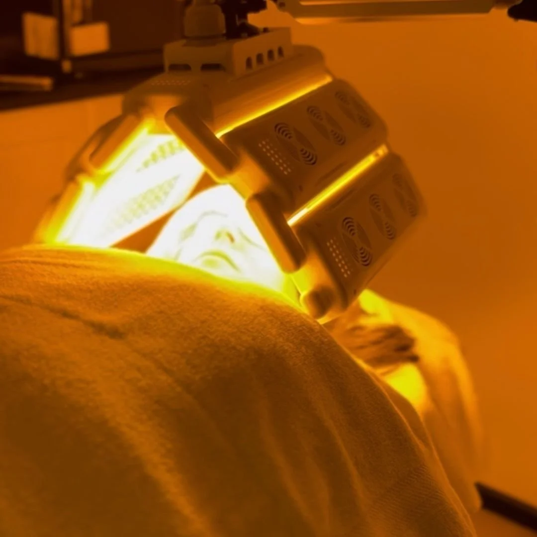 Yellow Light LED Therapy.