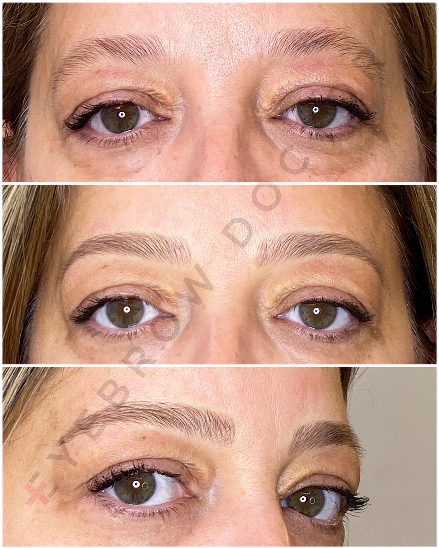 Fresh brows.Swipe for more.To book visit EyebrowDoctor.com
