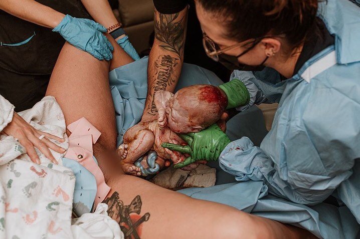 Sweet baby born in the ice storm straight into dad&rsquo;s hands! Welcomed by Midwife Melissa last week. 💜
Amazing capture by @jennavanloon.doulatog