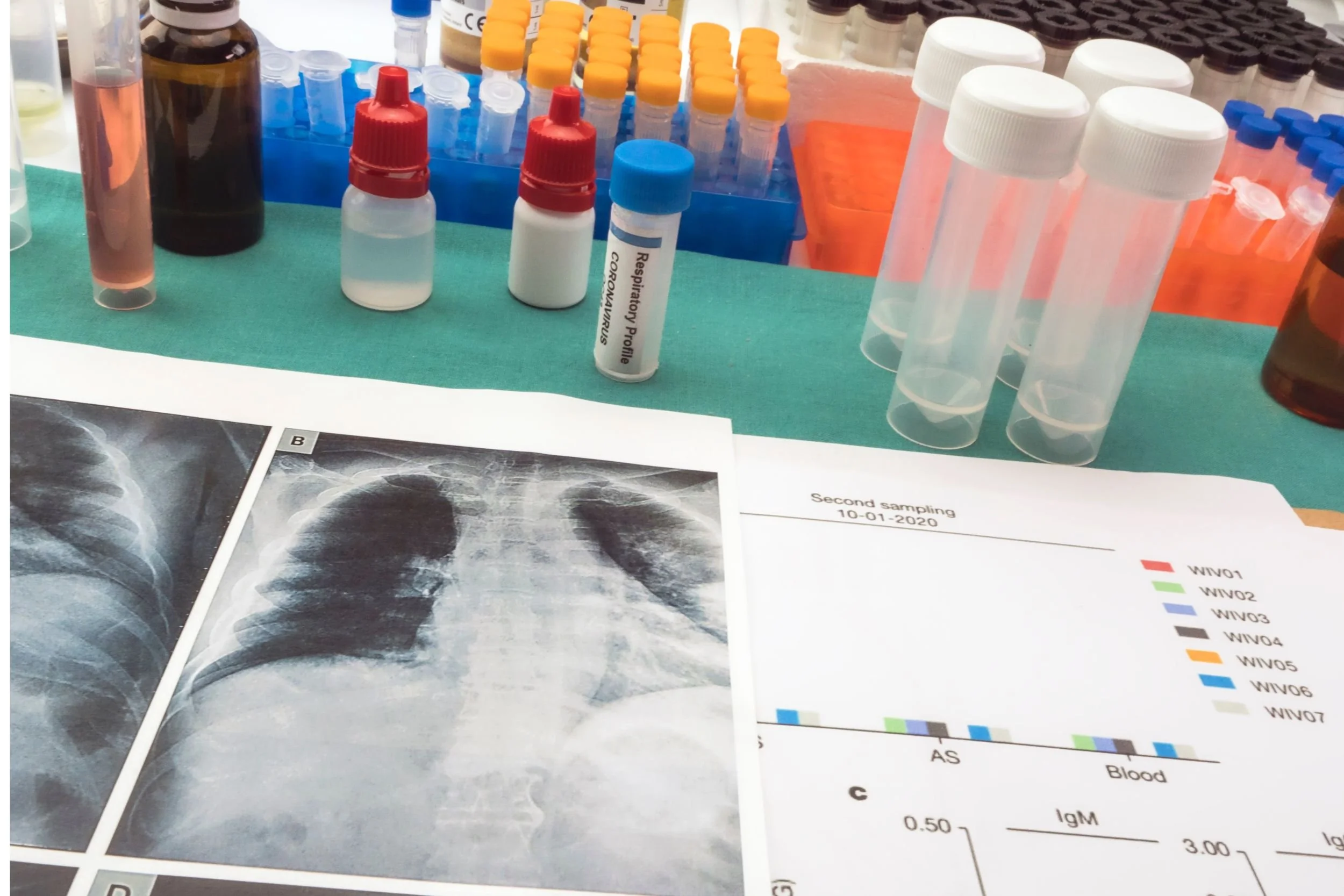 A medical exam focusing on respiratory analysis. Test tubes, sample bottles, and printed documents displaying patient data are arranged on a table.