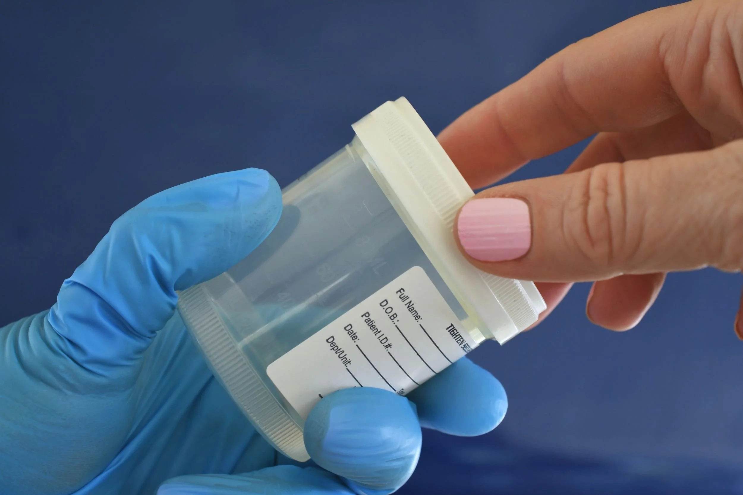 A medical professional wearing blue gloves hands an empty sample collection container to a patient.