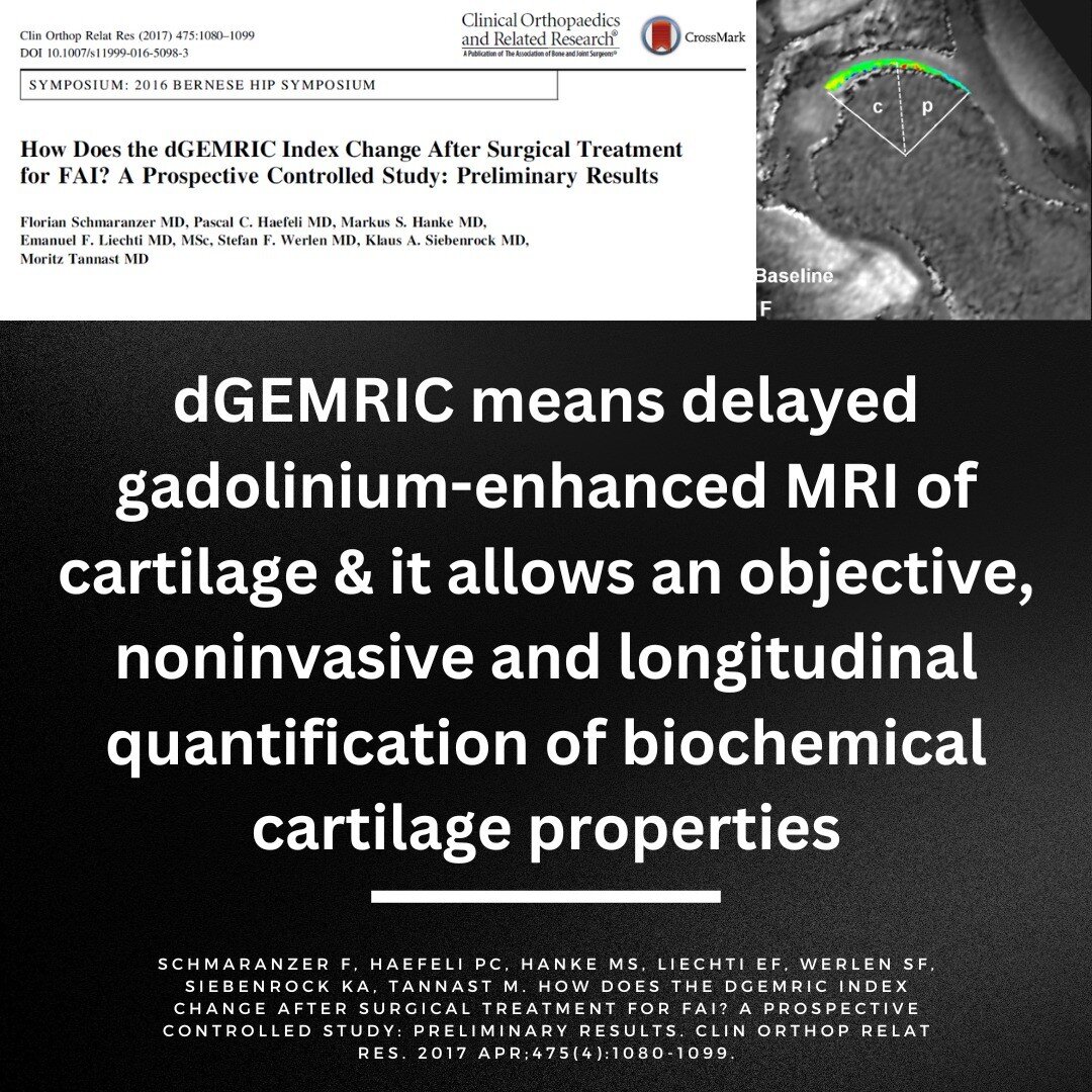 There is still a lot of uncertainty surrounding the effects of both hip preservation surgery and FAI on cartilage integrity.

Remember the labrum is a ring of cartilage along the inside of the hip socket.

In other words, how does FAI change the hip 