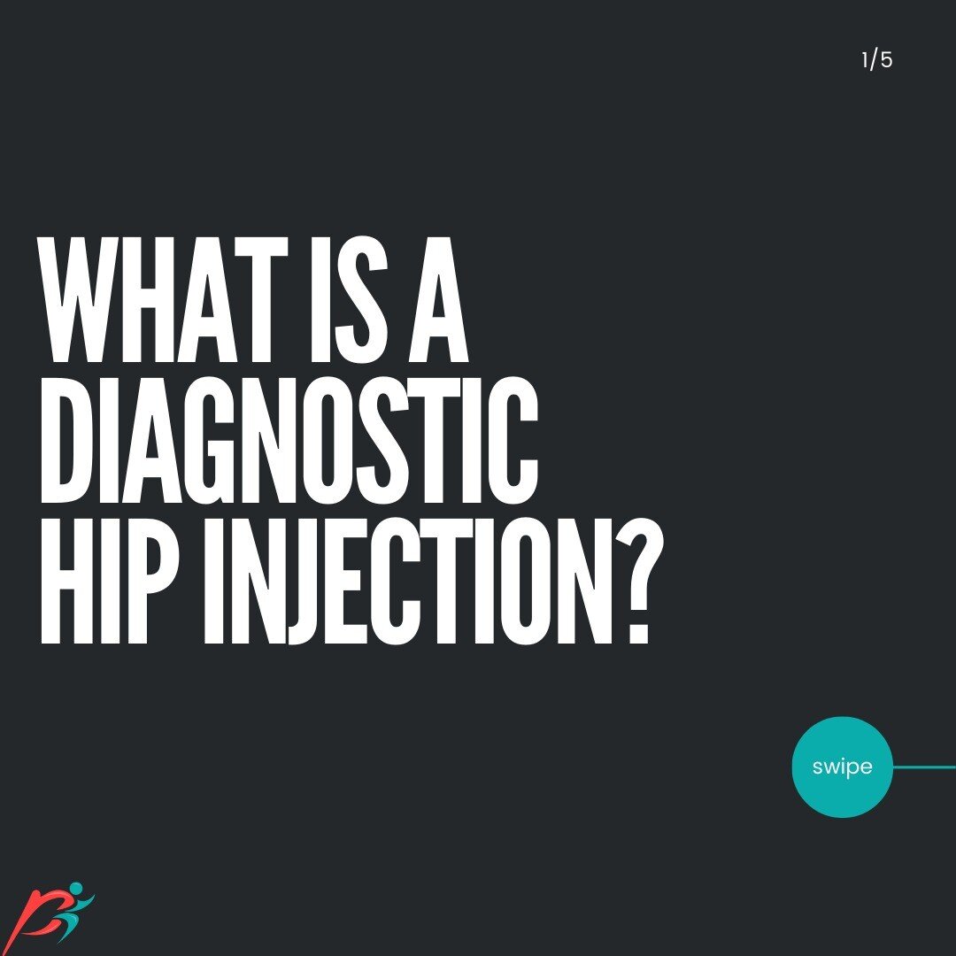 What is a diagnostic hip injection?💉

‼️If you are considering getting a hip arthroscopy surgery for your hip pain, it is essential that you get a diagnostic hip injection.‼️

A diagnostic hip injection is when a local anesthetic (usually along with