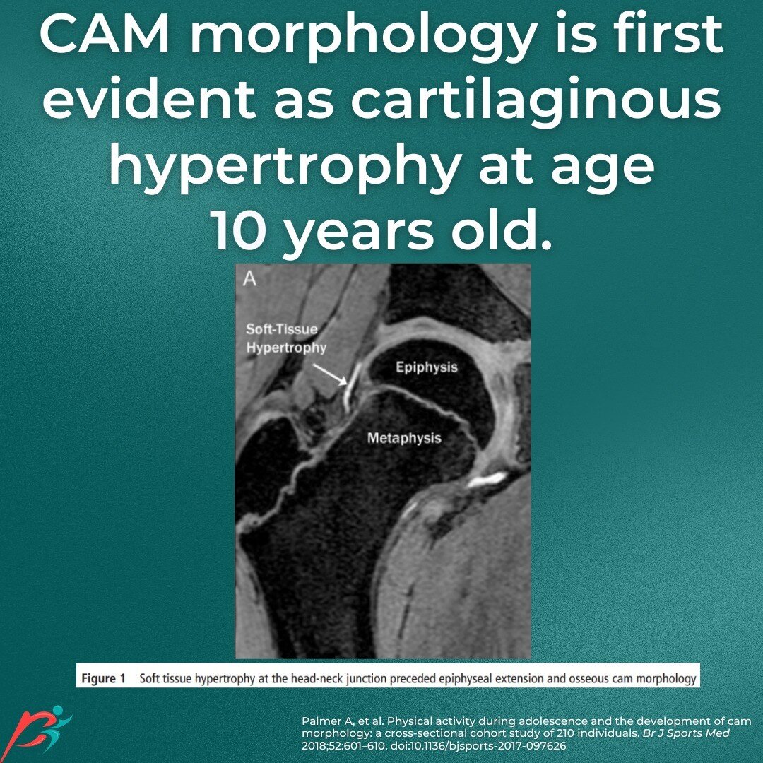 In this study, researchers found that CAM morphology first presents as cartilage changes in kids as early as 10 years of age.

These changes in the cartilage are labeled as 'soft-tissue hypertrophy'.

It makes you ponder the question...if we implemen