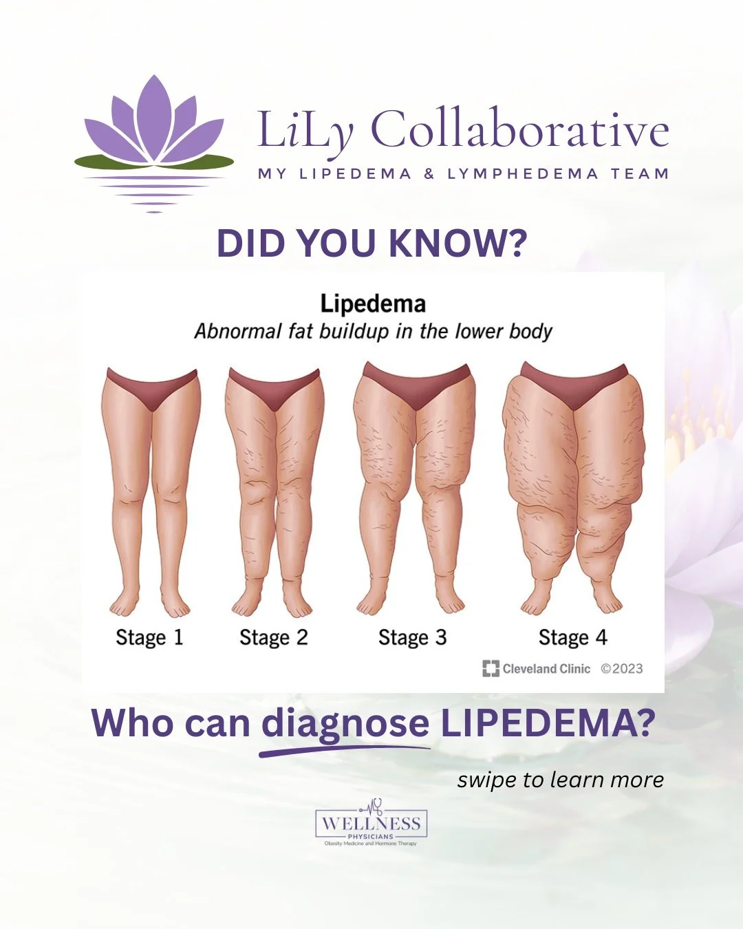 Who actually diagnoses lipedema? Here's what I'm seeing in clinic.

I get this question every week and the answer tells you something important about why lipedema goes missed for so long.

The short answer: any physician can diagnose it: vascular spe