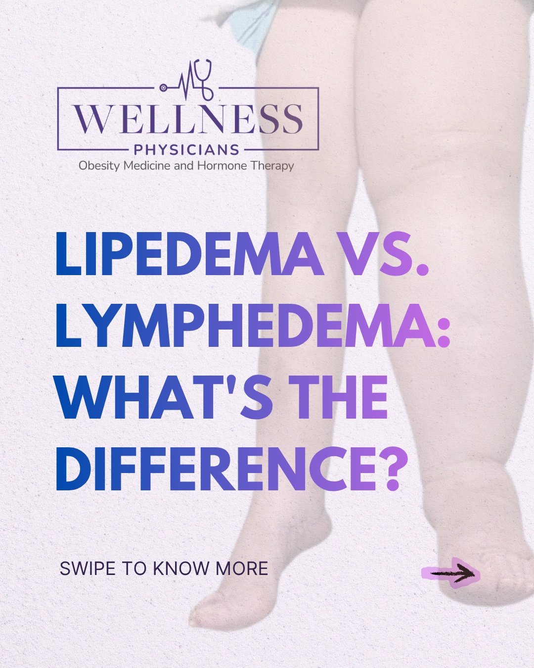 Lipedema and lymphedema get mixed up a lot, and we get why. The symptoms can look similar on the surface, but they are different conditions with different treatment plans.

Understanding what you're actually dealing with is the first step to feeling 