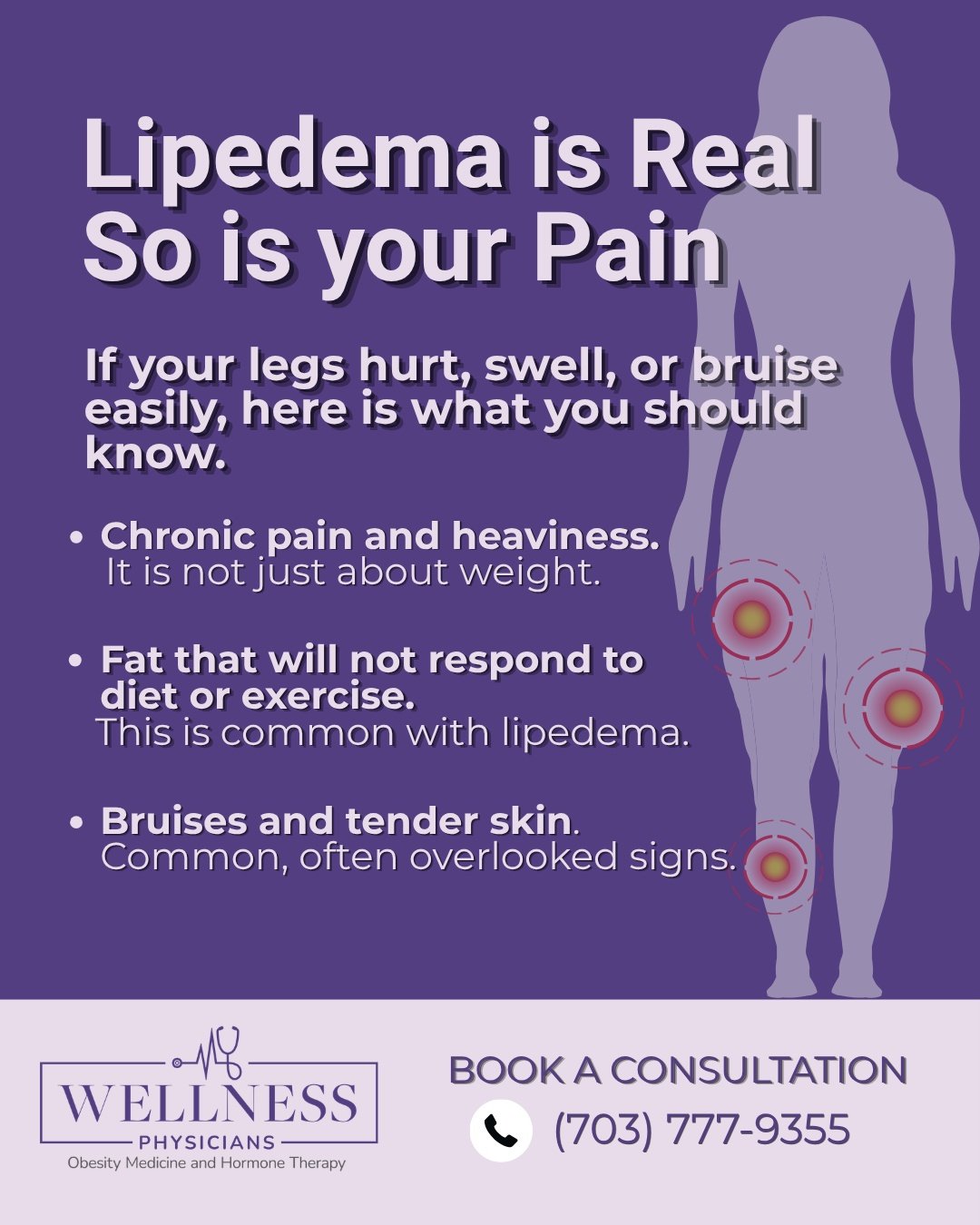 If your legs hurt, swell, or bruise easily and no one has given you real answers, you are not imagining it. These are common signs of lipedema, a real condition that deserves a real diagnosis and a real plan. Save this post and share it with someone 