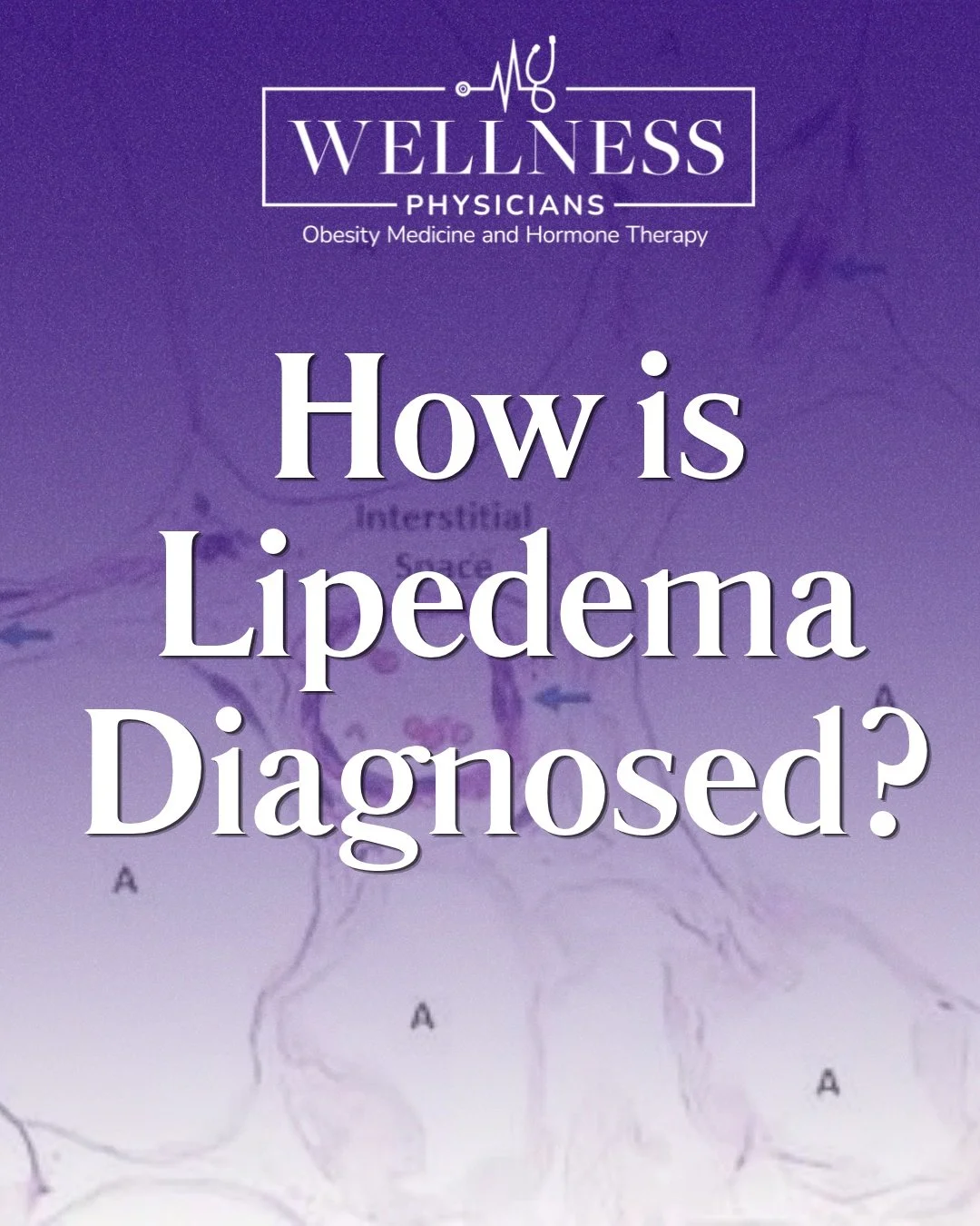 Lipedema affects an estimated 1 in 9 women, yet many go years without a diagnosis.

It's often mistaken for weight gain and no single test can confirm it. Instead, lipedema is diagnosed through a careful clinical evaluation:

🔹 A detailed health his