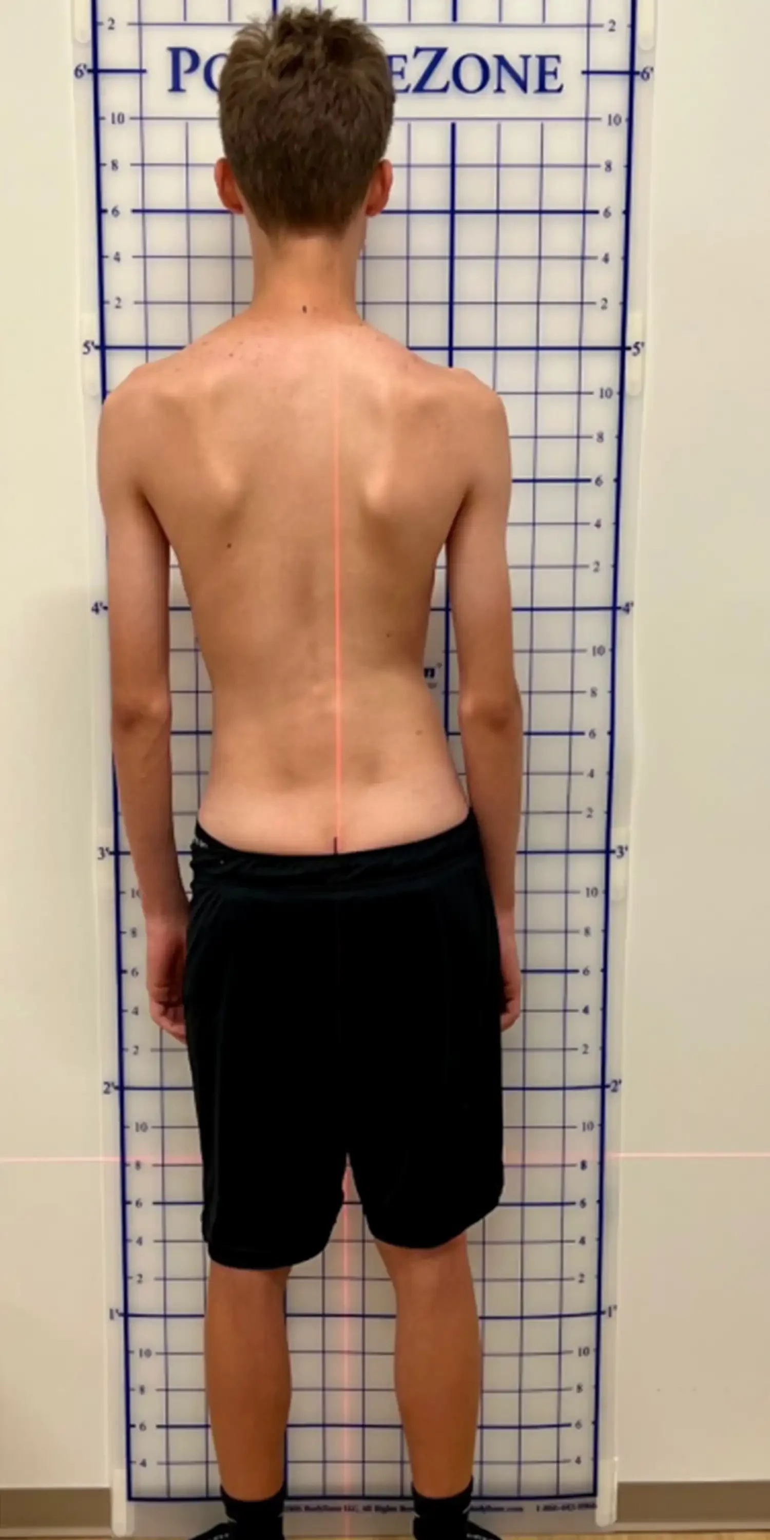 before standing posture