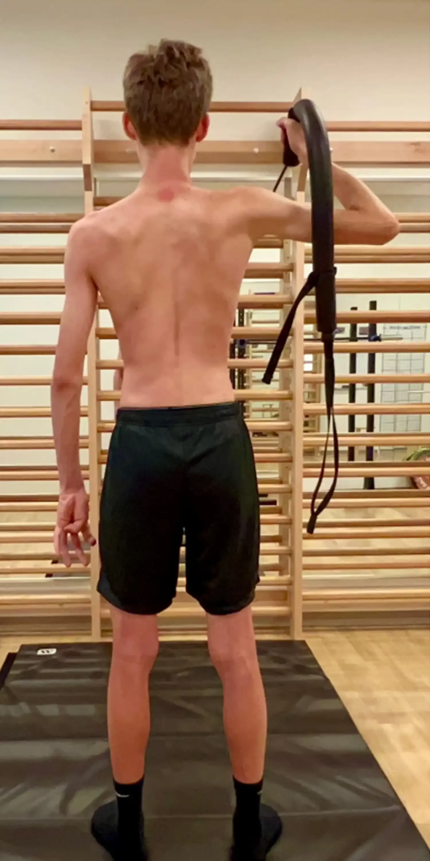 after scoliosis transformation