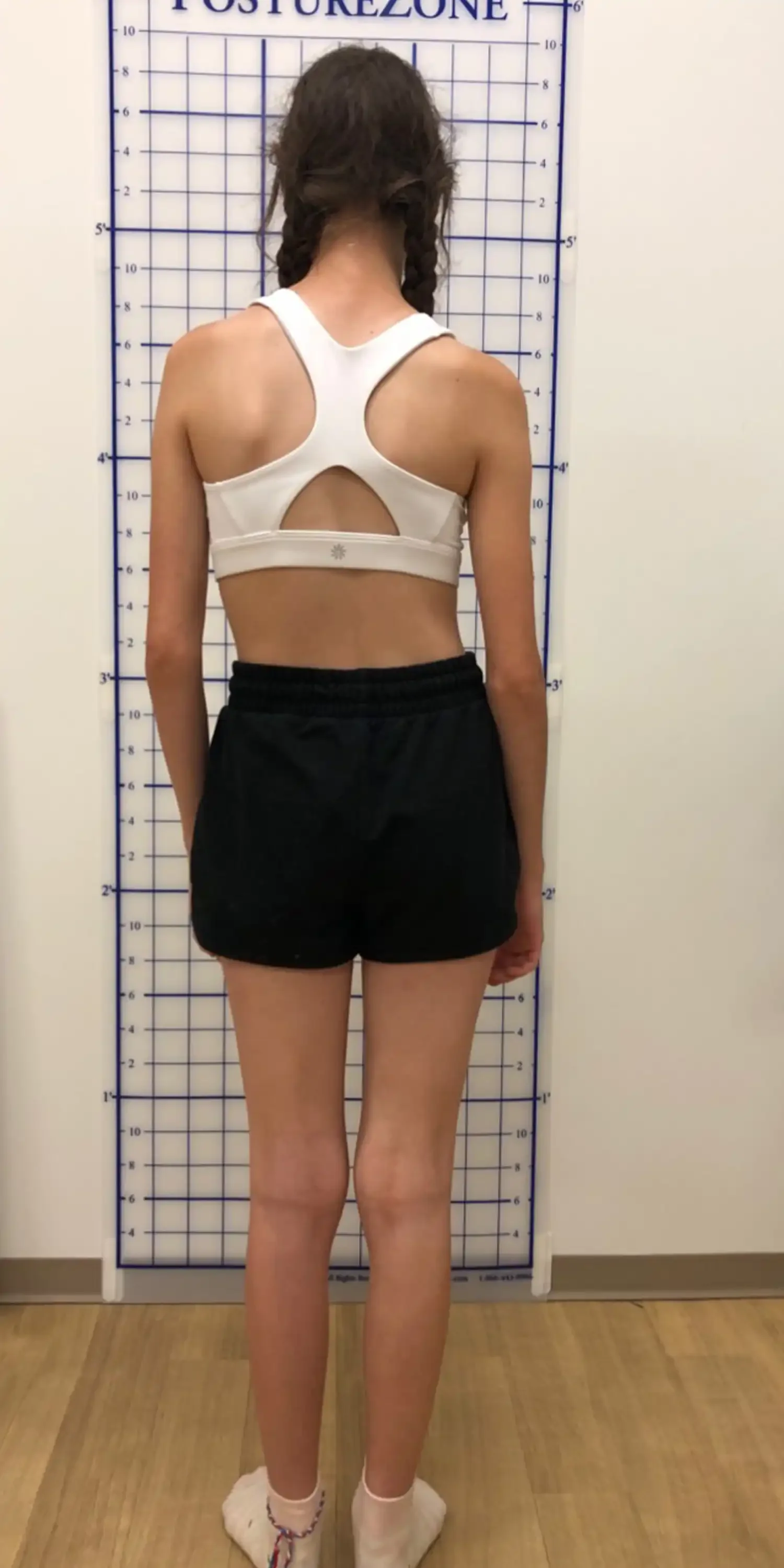 before standing posture