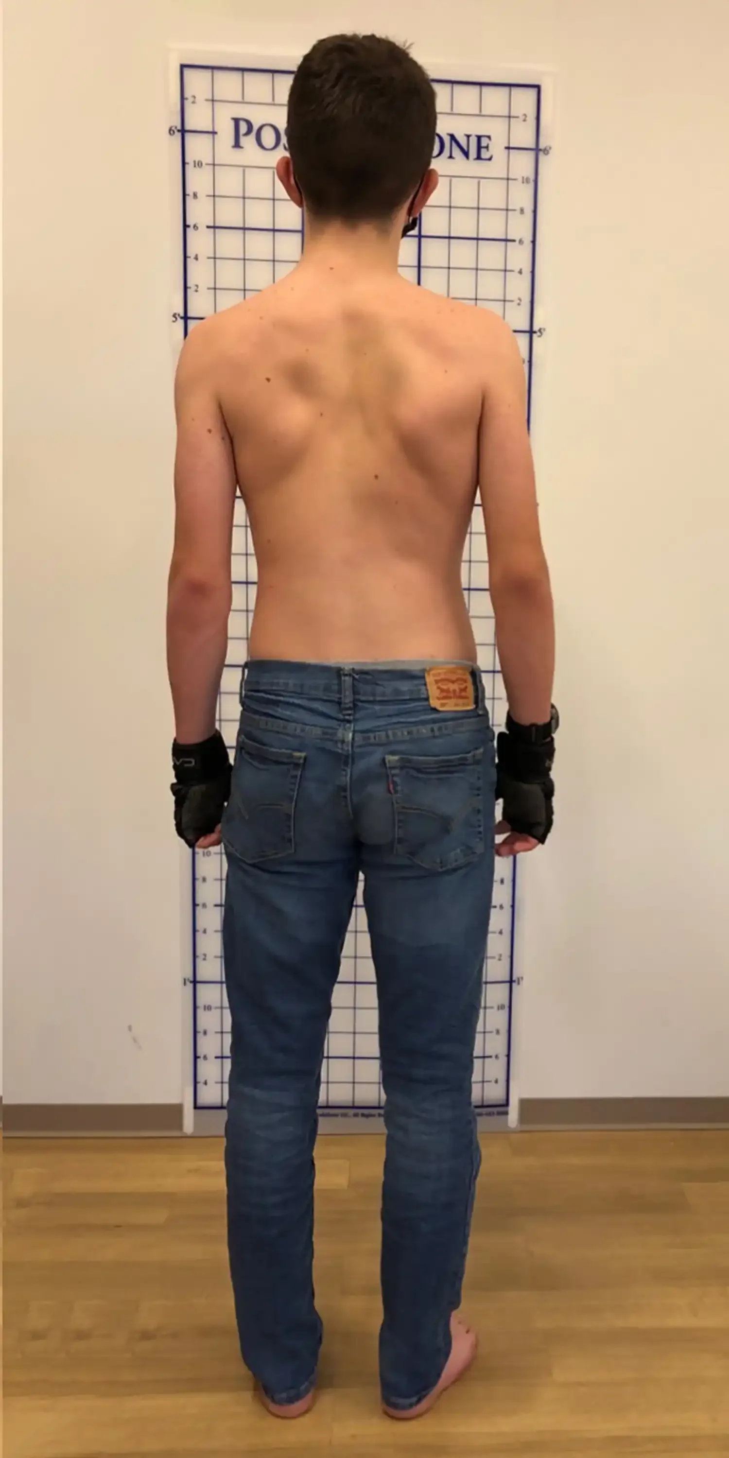after standing posture
