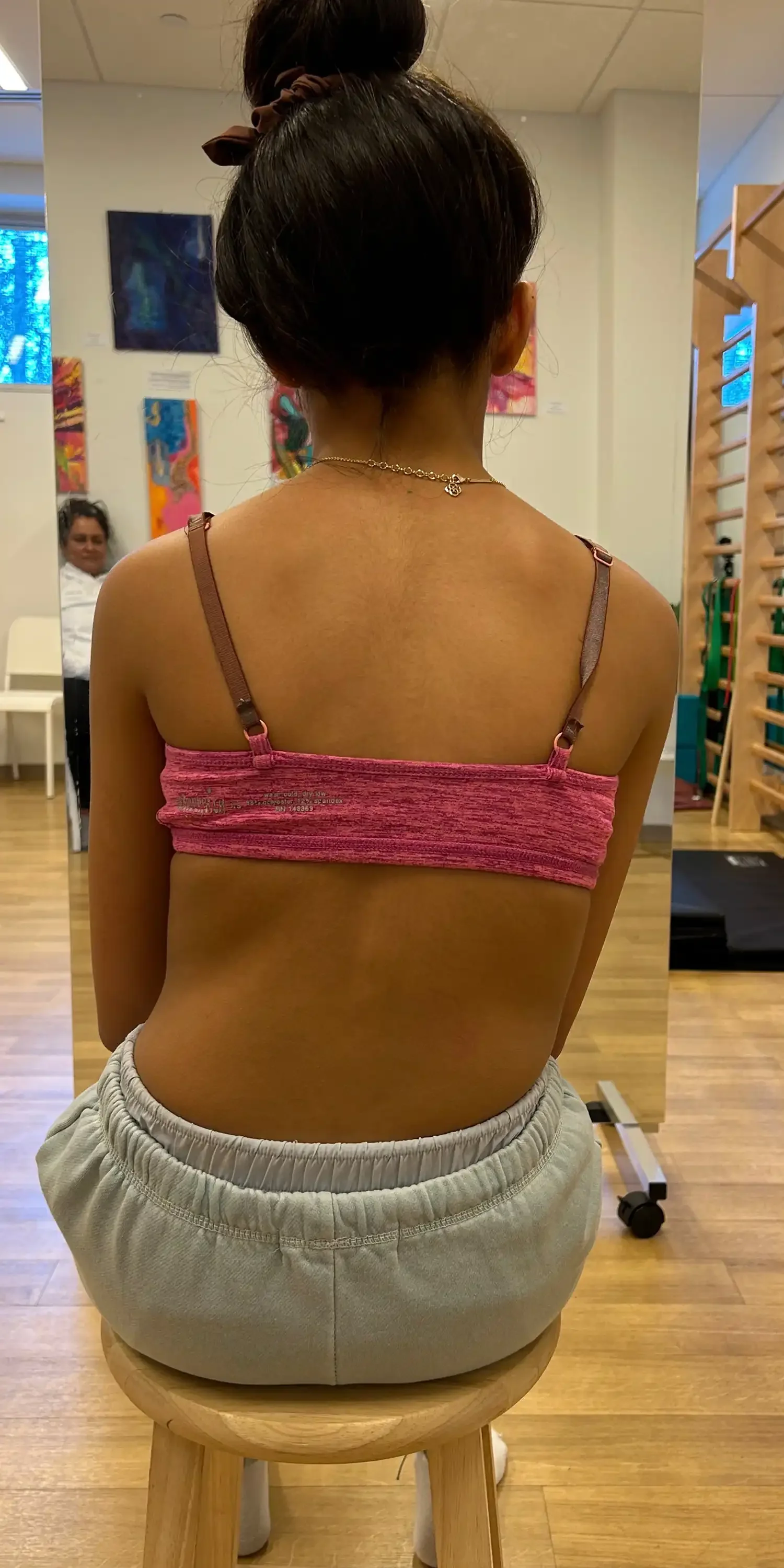 11 yr old before scoliosis transformation