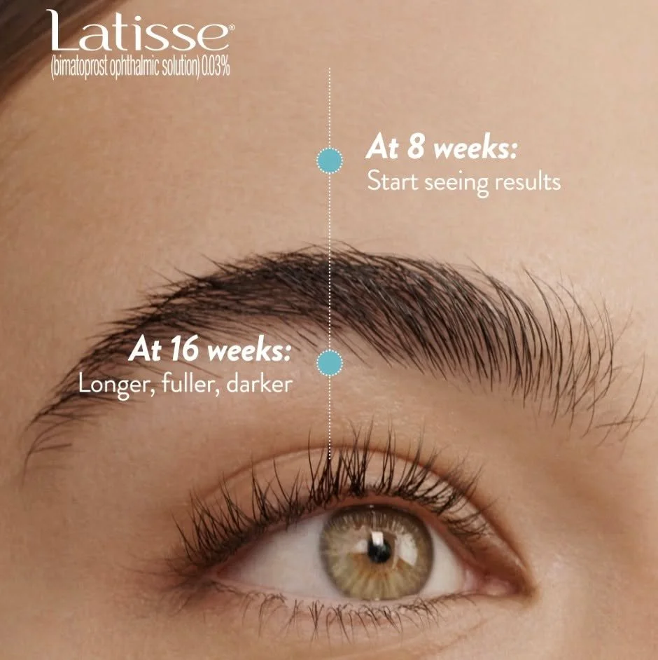 Longer, fuller, darker lashes at 16 weeks. 😍 The sooner you start your prescription, the sooner you start seeing results! Visit our office to learn more about Latisse!