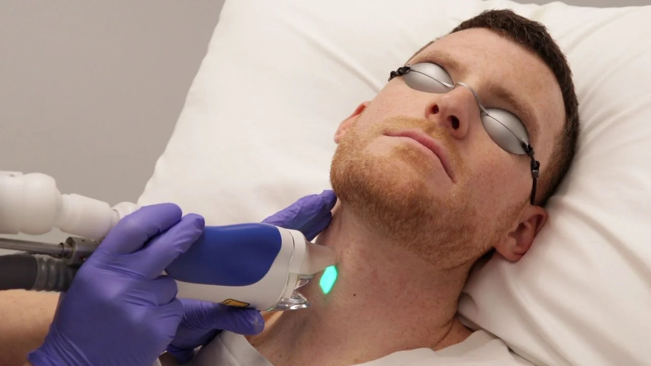 Keratosis Pilaris — Beautilase