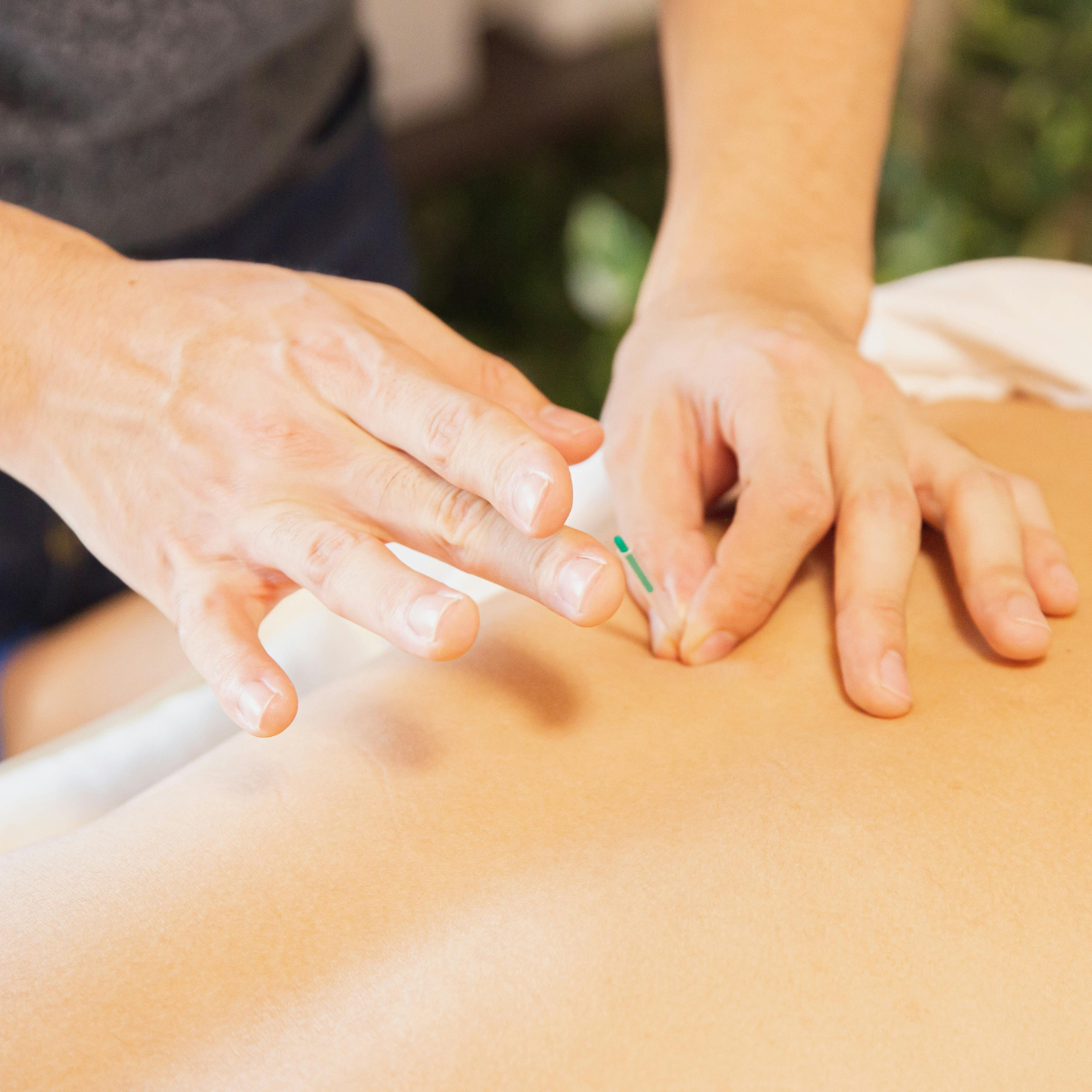 Verspannung_Dry-Needling_Körpertherapie_Berlin