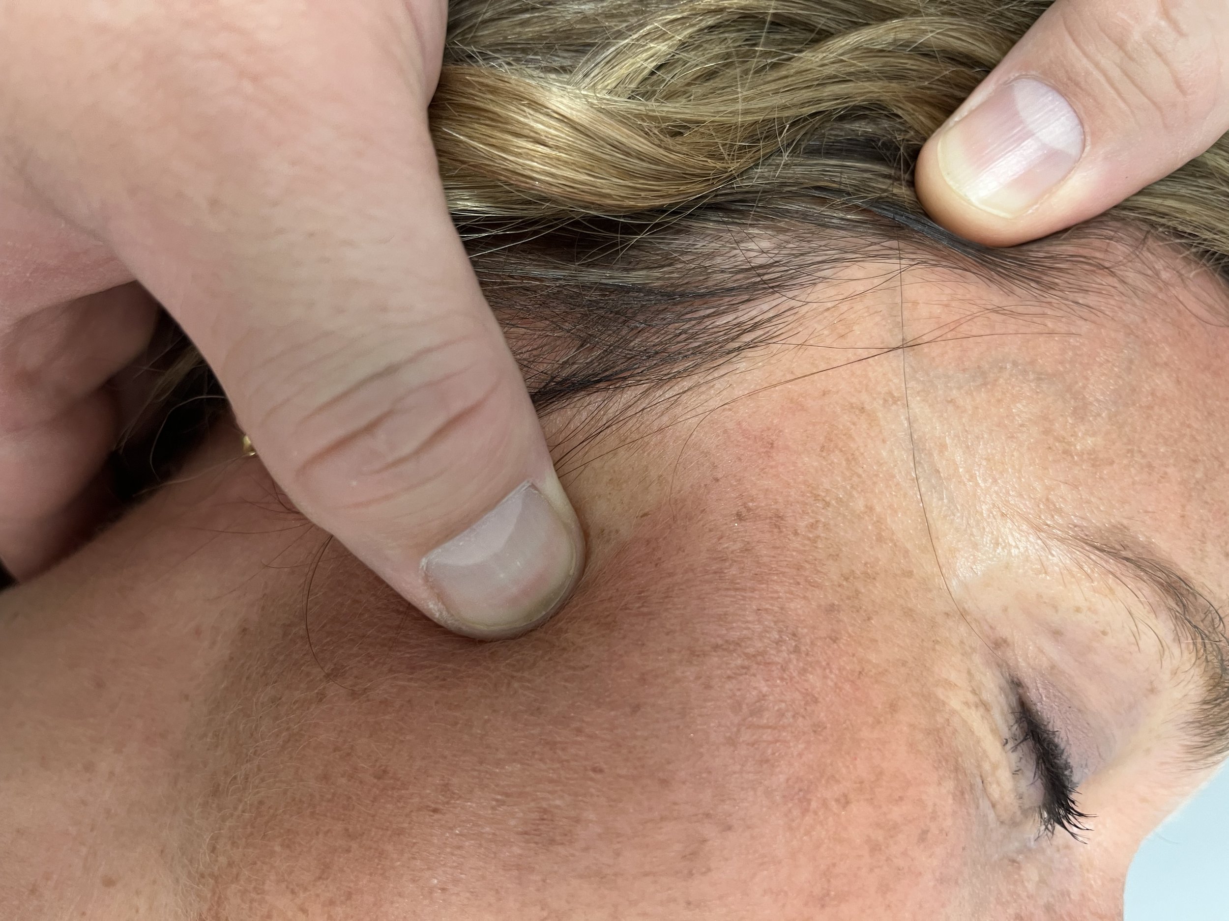 Advancing Patient Care Through Continuing Education: Dr. Logan Brooke Learns Myofascial Disruption Technique
