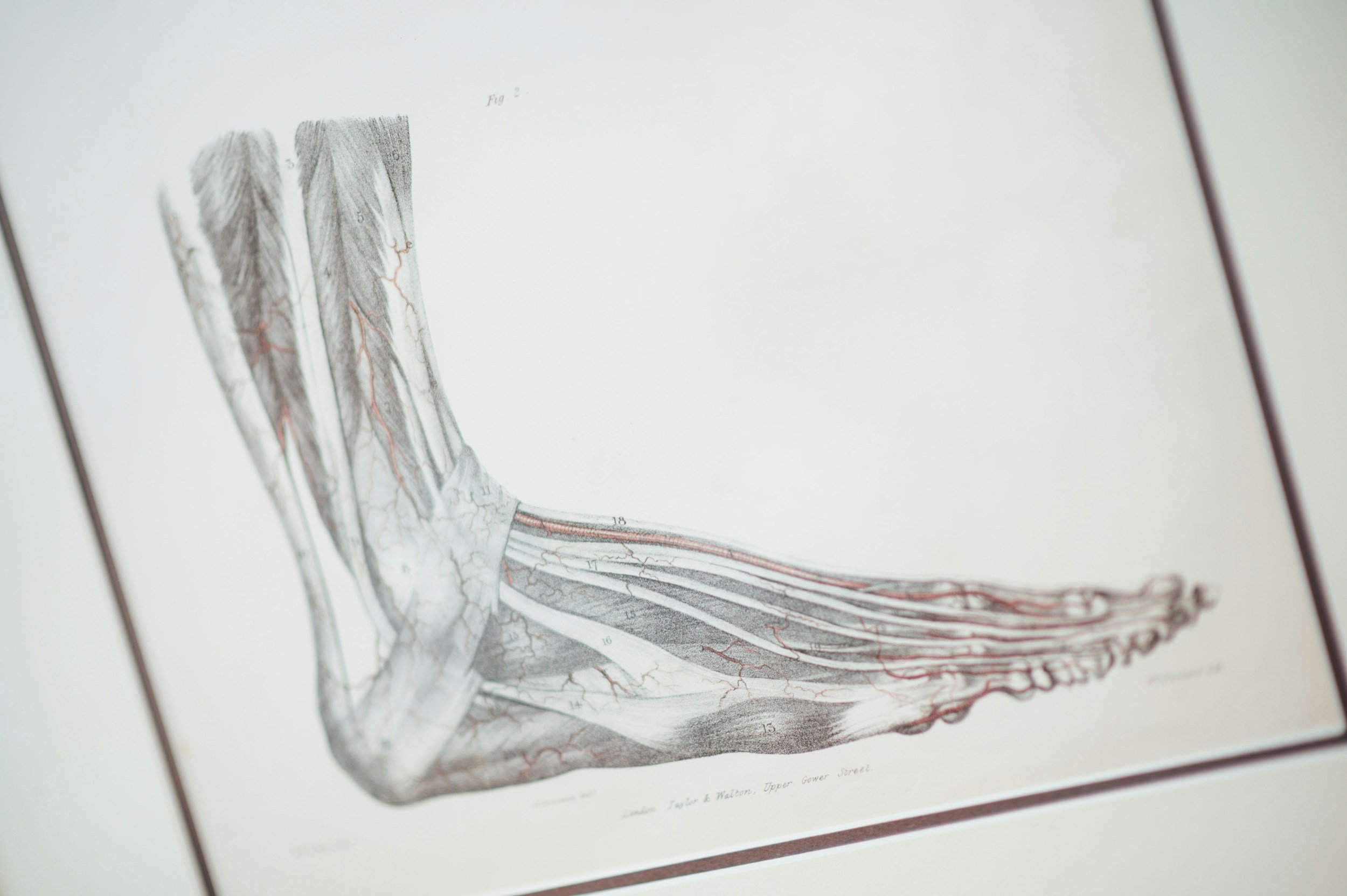 On Tendons
