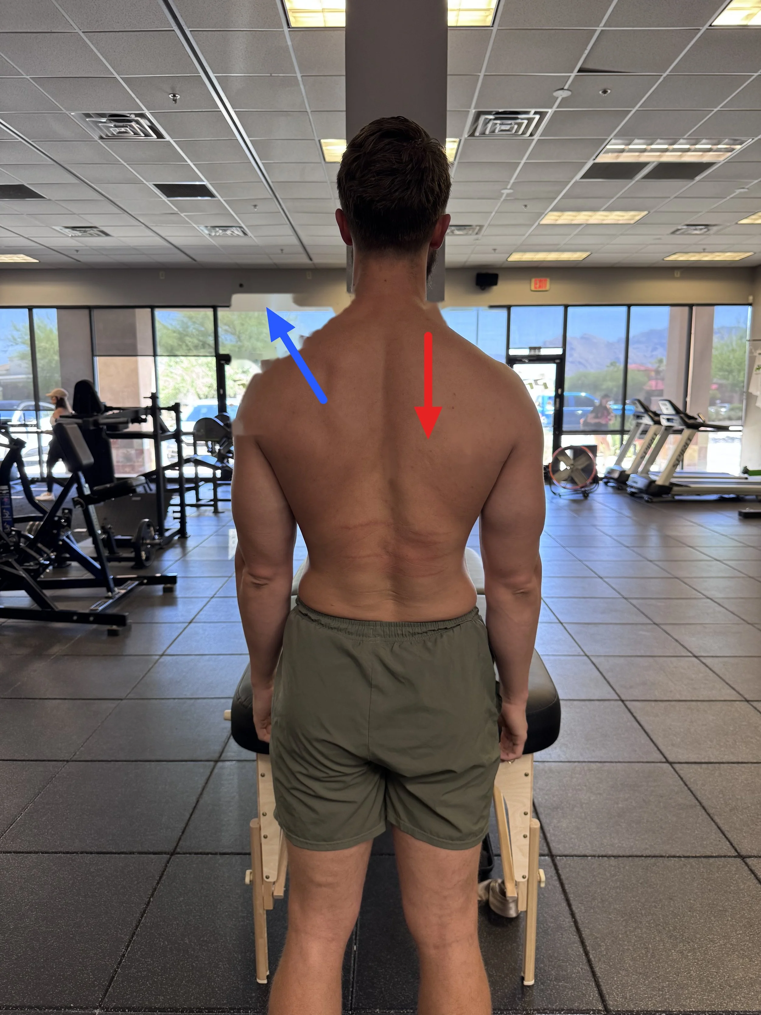 The Thoracic Spine and Shoulder Mechanics