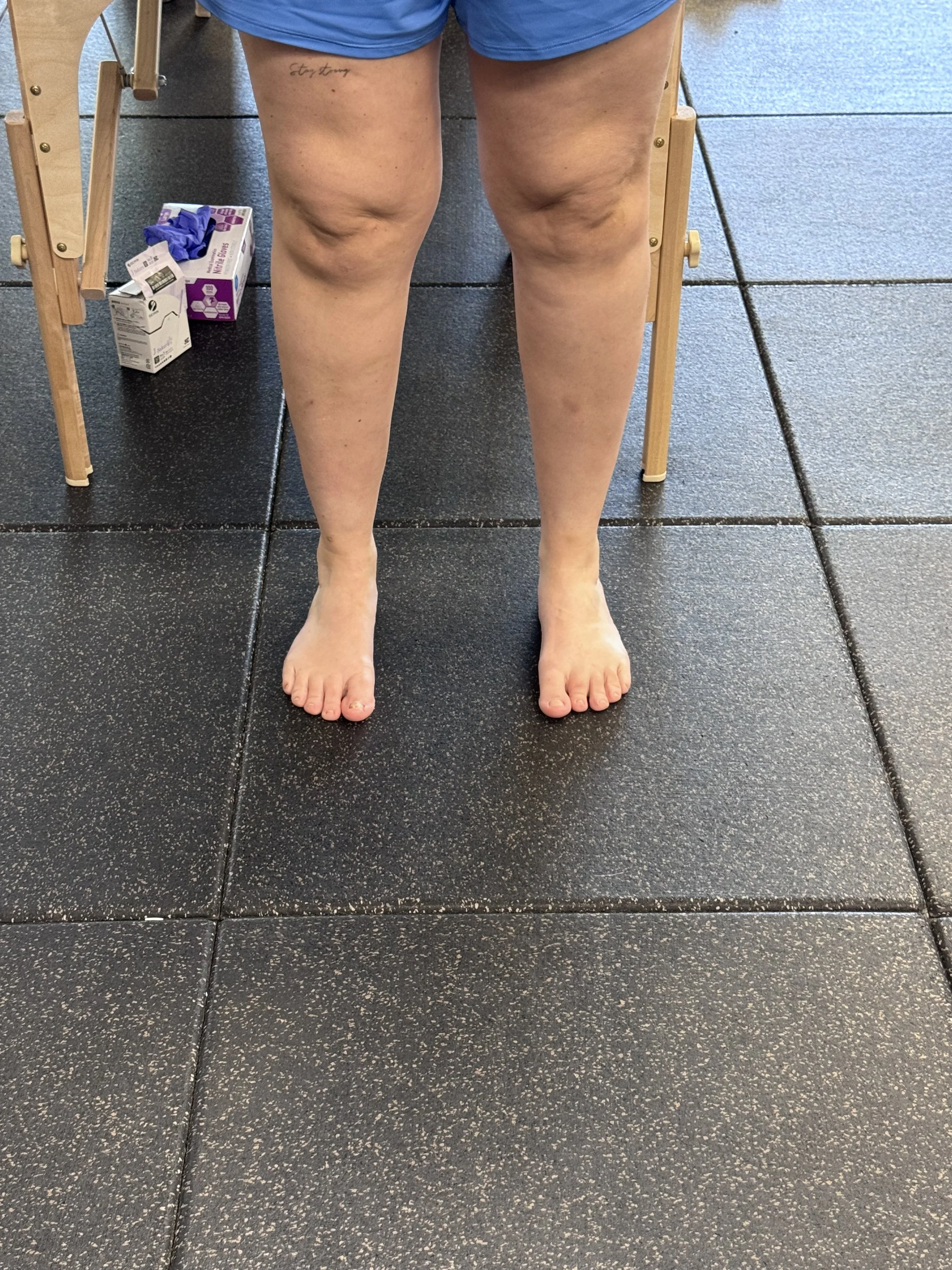Toe Spreaders