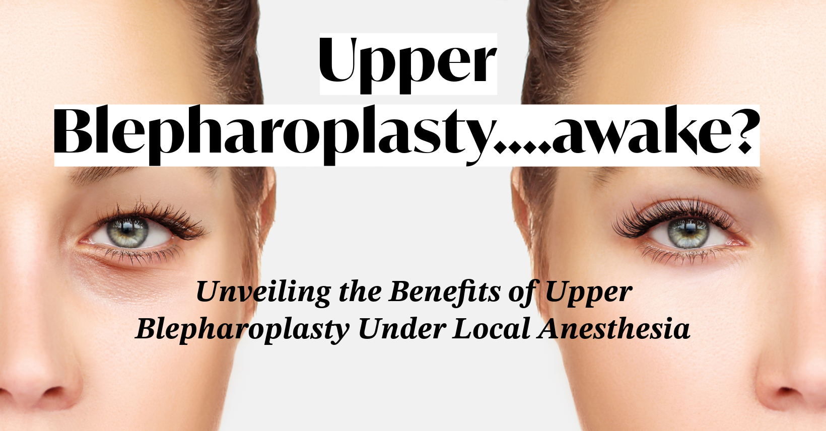 Upper Blepharoplasty…awake?