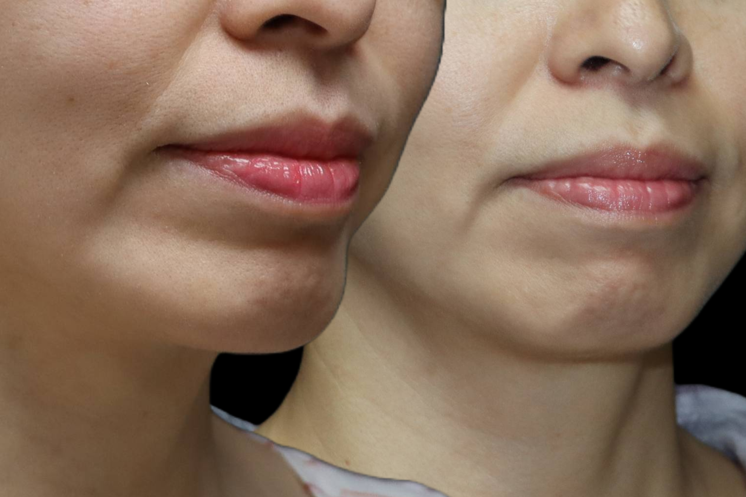 TRAKY CHIN-5-WEB2.png