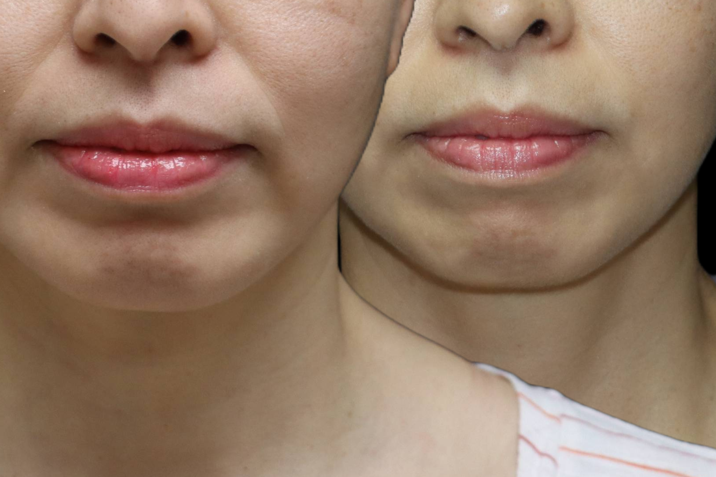 TRAKY CHIN-4-WEB1.png