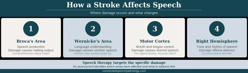 Speech Therapy After a Stroke – Recovery Exercises for Stroke Patients ...