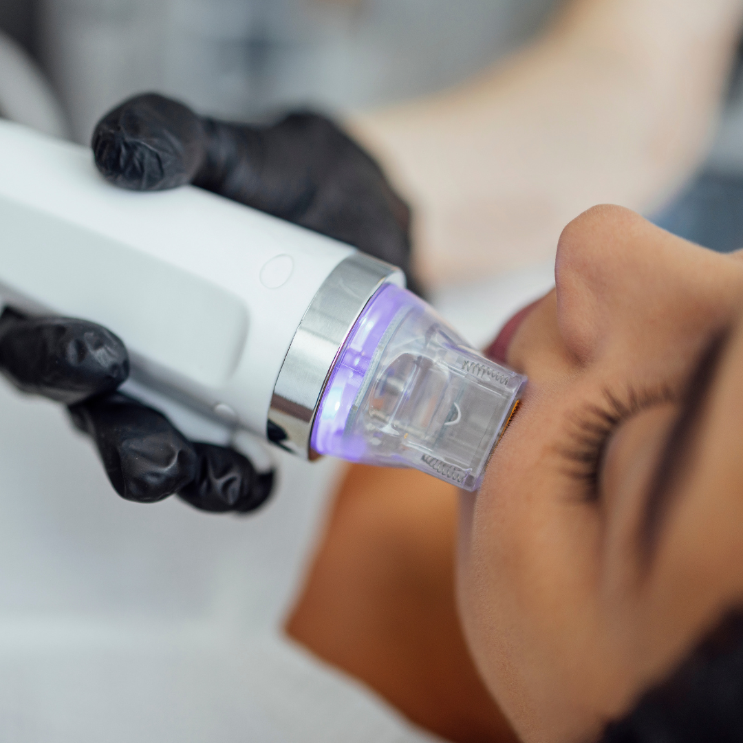 $250 OFF ENDYMED - Microneedling with RF (3 PACK)