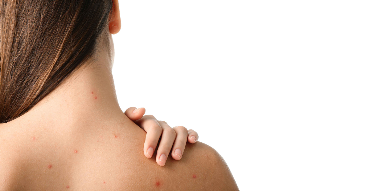 Acne Back Facial (50 mins)