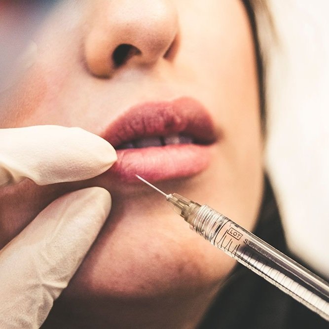 How Facial Aesthetics Can Boost Your Self-Confidence (without changing who you are)