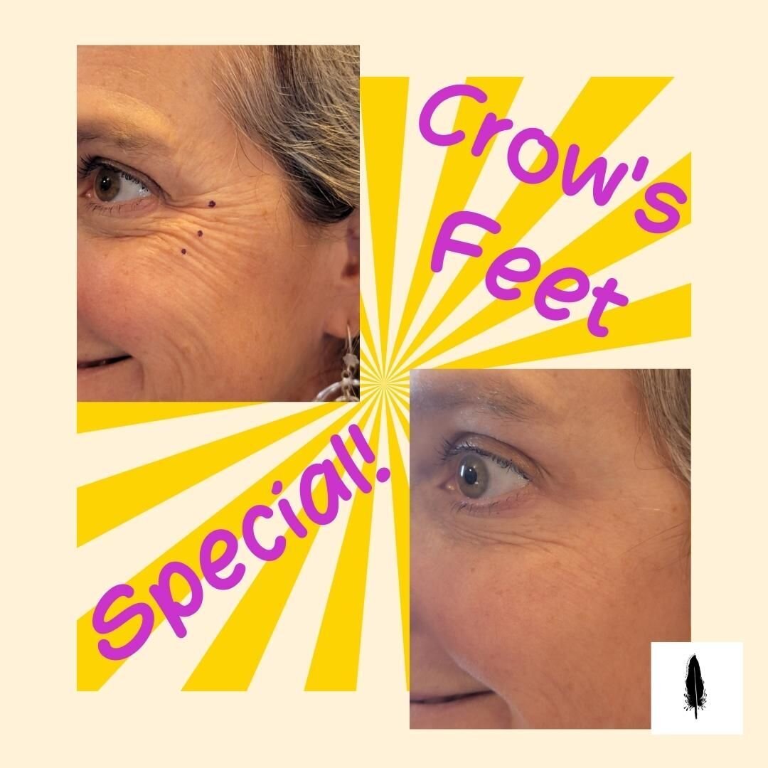 Only 2 weeks left to take advantage of our April special!
$120 crow's feet treatment to smooth out and relax those squint lines around the eyes. This is one of the treatments that clients LOVE the most as it makes a noticeable difference and displays