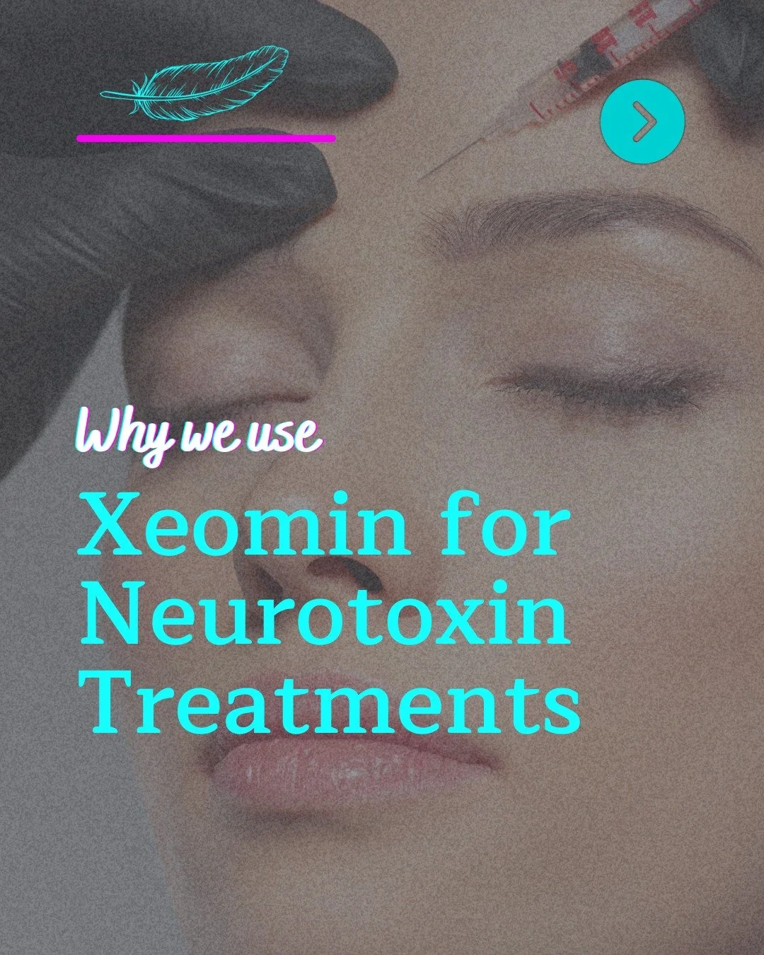 At Blackbird Aesthetics, we use Xeomin, a Merz product, rather than Botox as our main botulinum toxin. While a few people may respond better to one or the other, most clients notice very similar results with either. Choosing Xeomin fulfills our goal 
