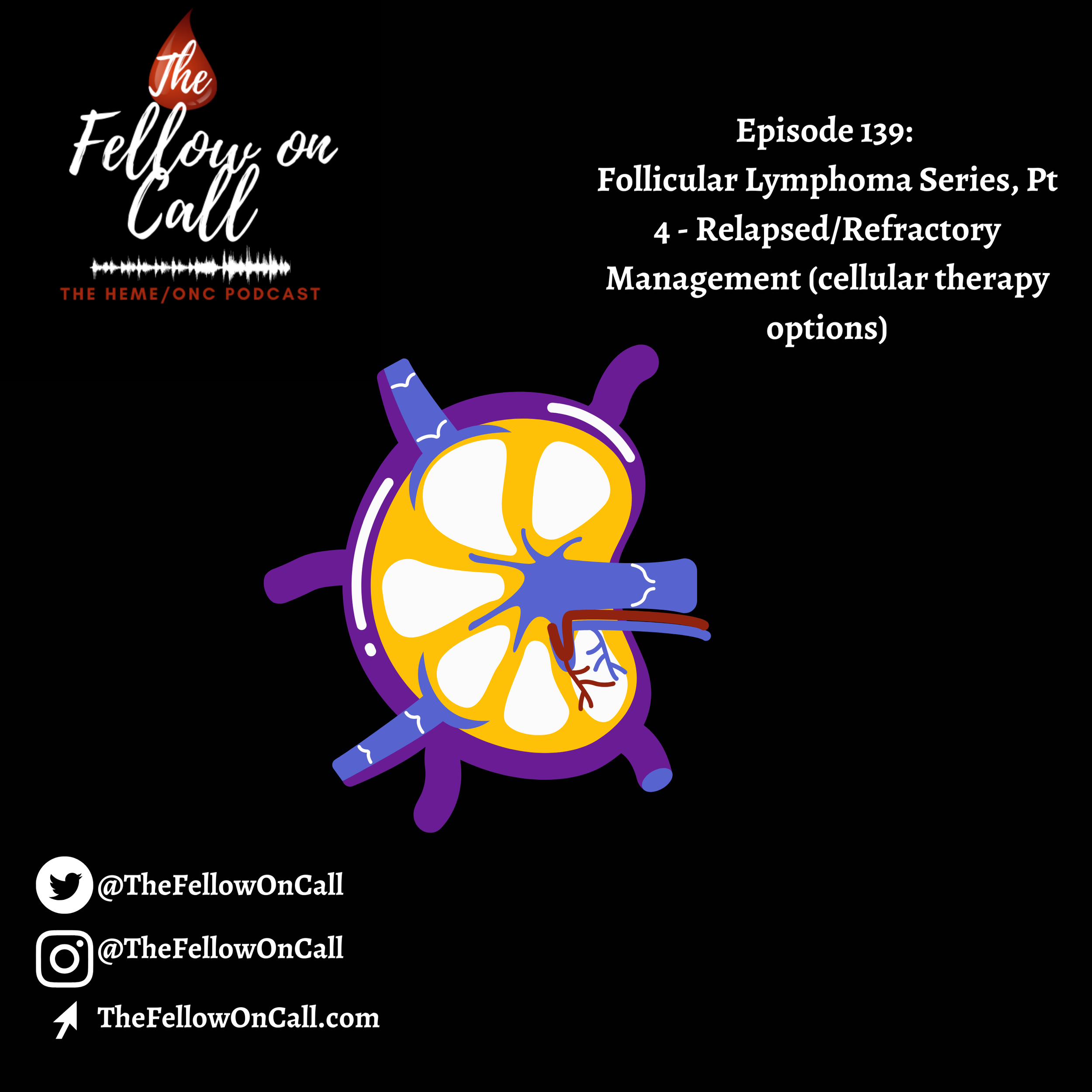Episode 139: Follicular Lymphoma Series, Pt 4 - Relapsed/Refractory Management (Cellular therapy options)
