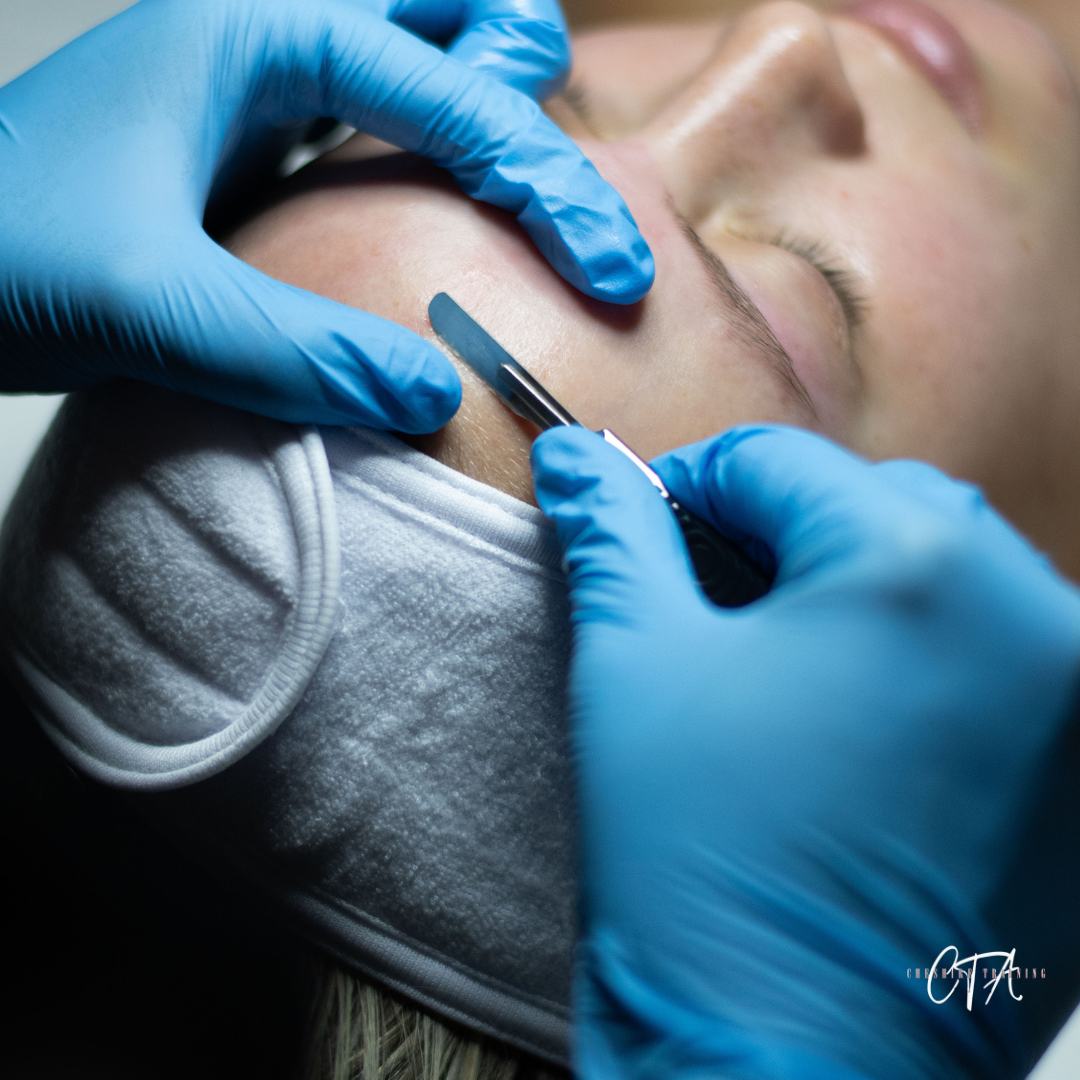 DERMAPLANING