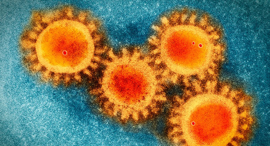 Temperature Checks Won't Catch Coronavirus Cases Without Fever