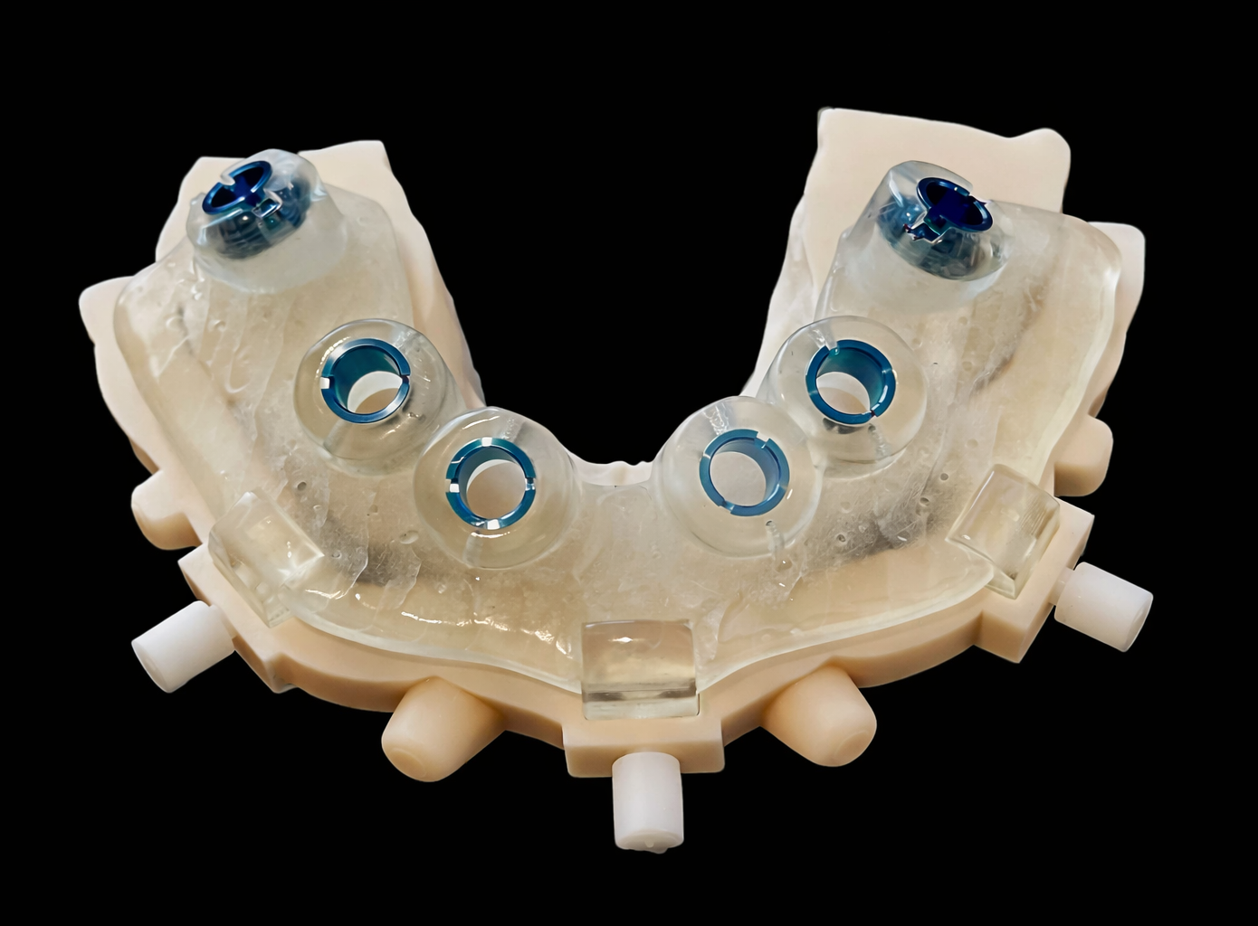 Stackable Guide All On Stackable Surgical Guide — Digital Dental Solutions
