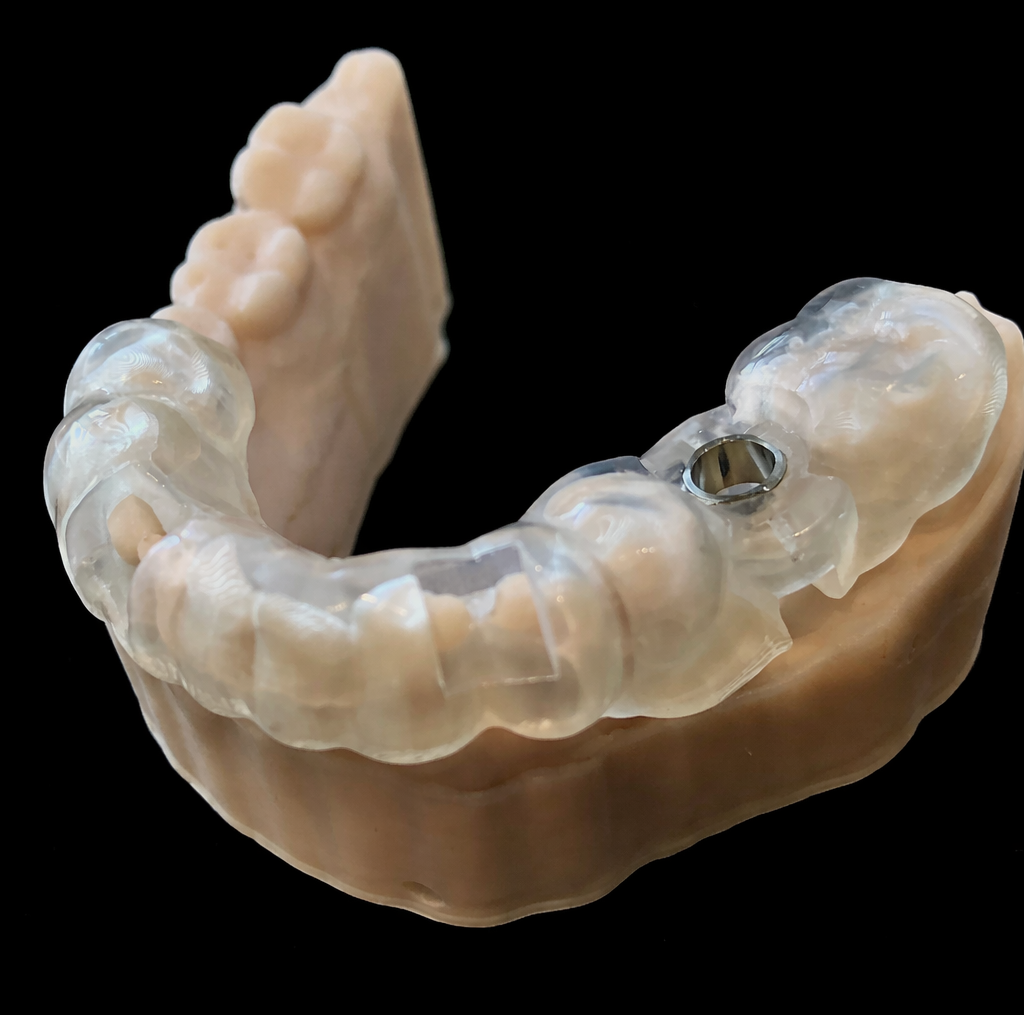 tooth-borne surgical guide