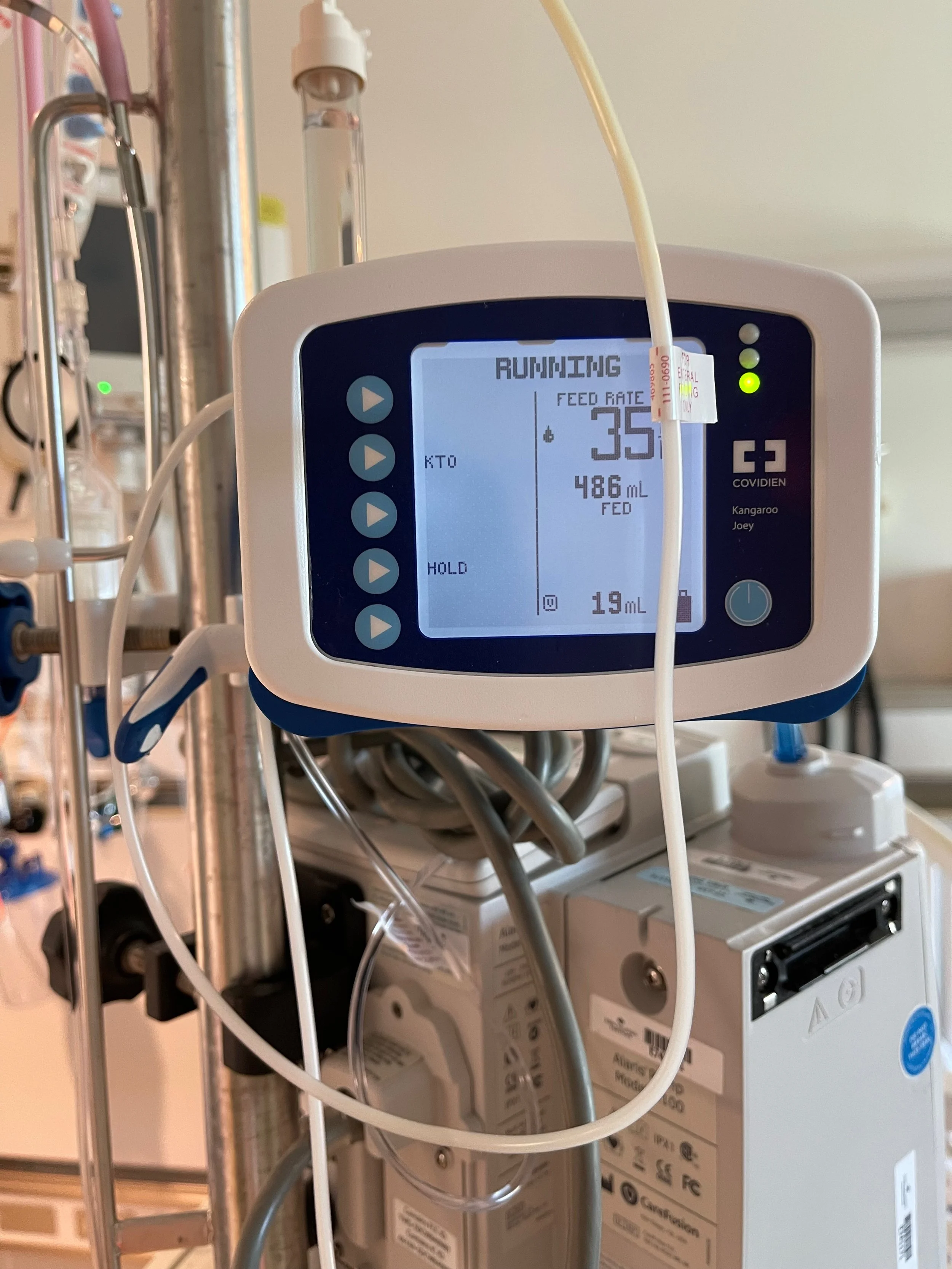 Medical infusion pump displaying a running status, feed rate of 35 mL/hour, and total of 486 mL administered.