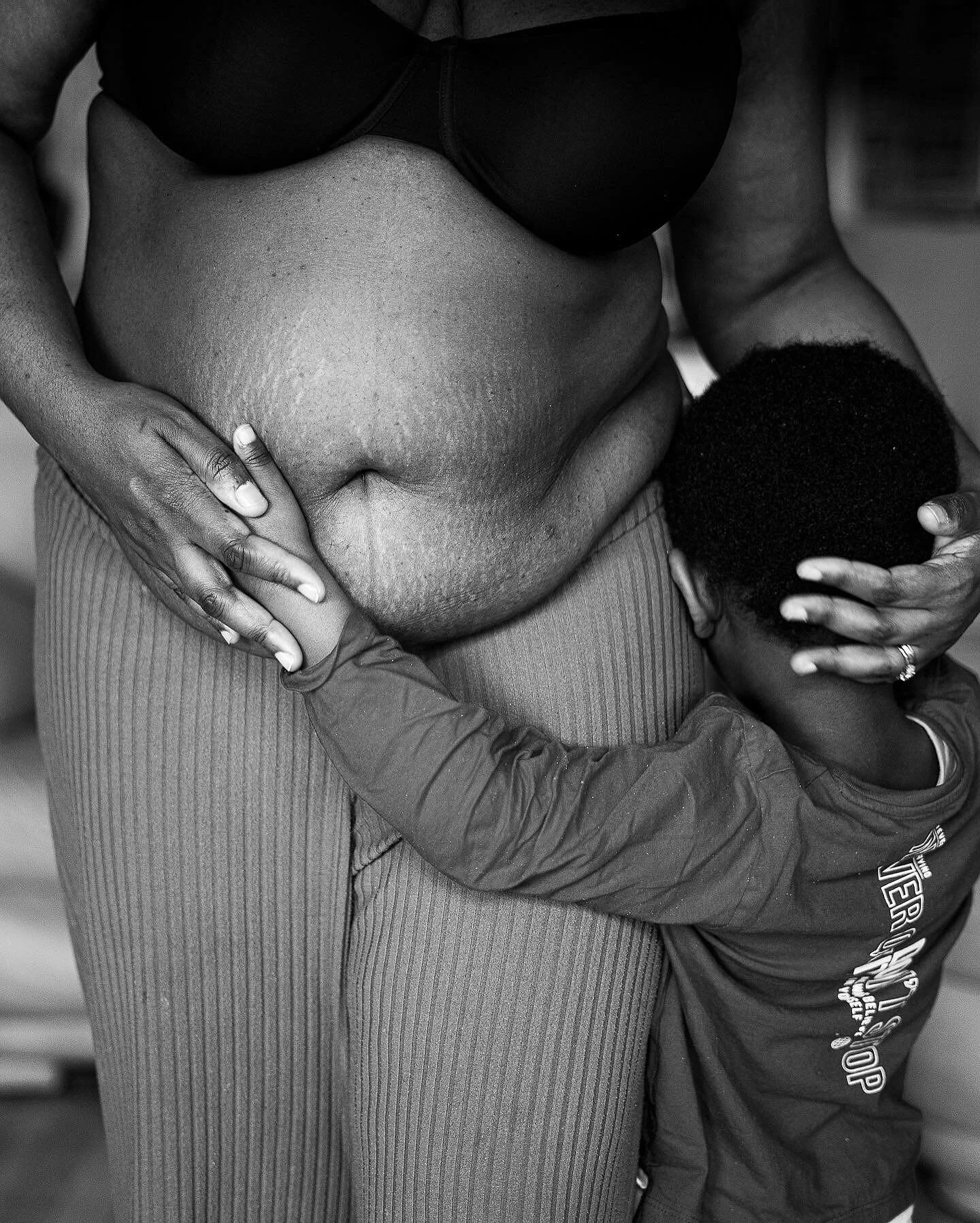 &ldquo;Offspring&rdquo; explores the physical and psychological changes that occur with the transition into motherhood from the perspective of Black mothers in the UK. The photographs of more visible physical changes like stretch marks, wrinkles, sca