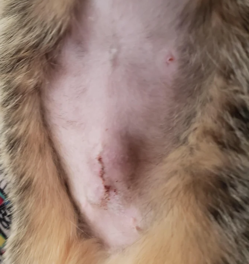 fluid collection at incision site