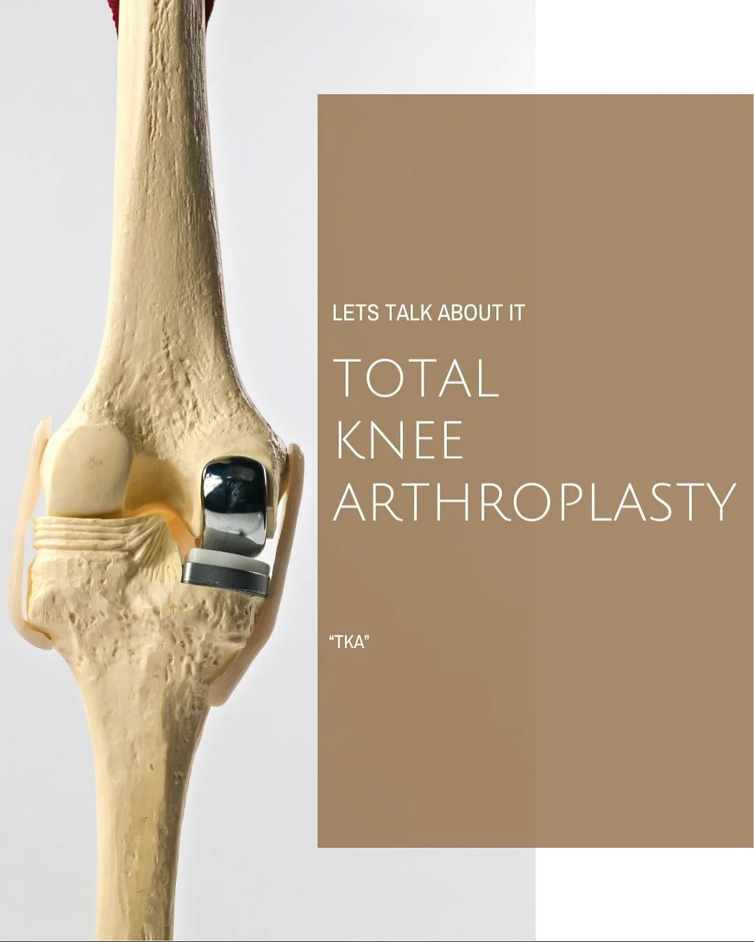 Deepening our knowledge on Total Knee Replacement — how it works, who needs it, and how it restores quality of life. 🧠💡