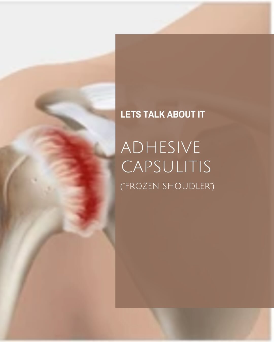 Let&rsquo;s Talk About: Adhesive Capsulitis (Frozen Shoulder) ✨