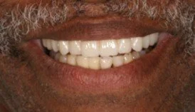 Close-up of a person's smiling mouth showing teeth and lips.