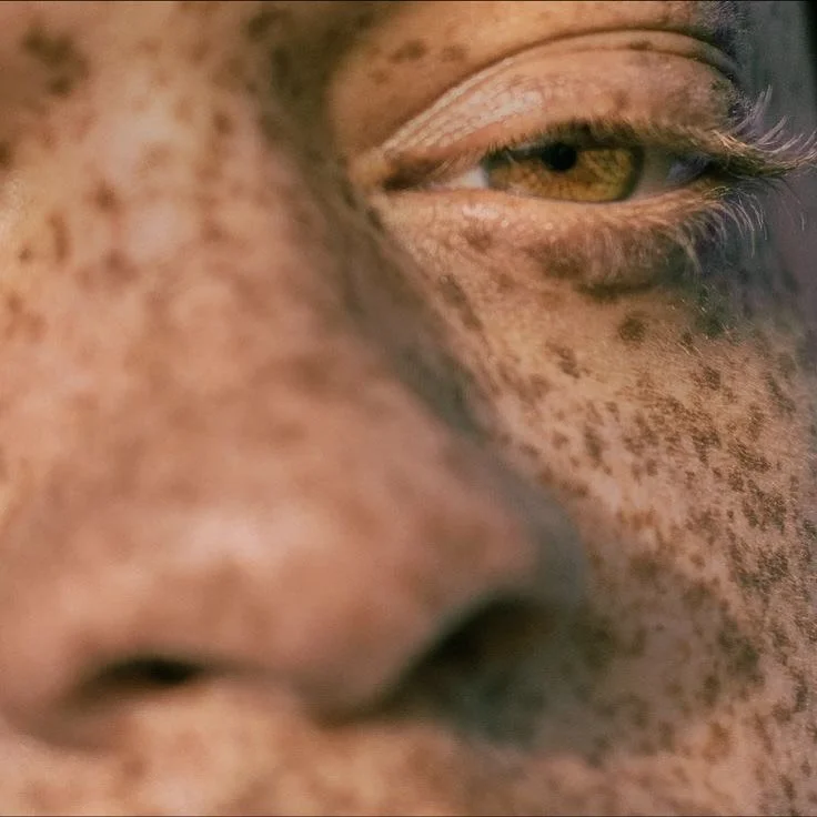 There&rsquo;s never been more noise (or confusion) around SPF, UV&nbsp;exposure, and &ldquo;sunscreen hacks.&rdquo; 

@adare_dermatology_chelsea recently opened their first UK flagship on Chelsea&rsquo;s Park Walk and have been working hard to cut th