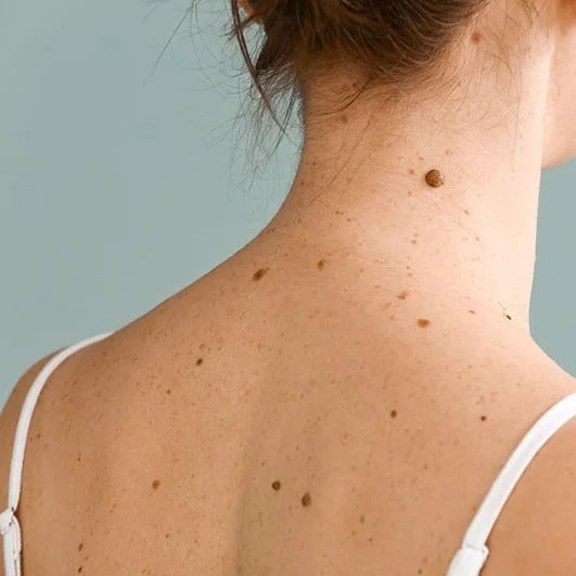 Premier Dermatology